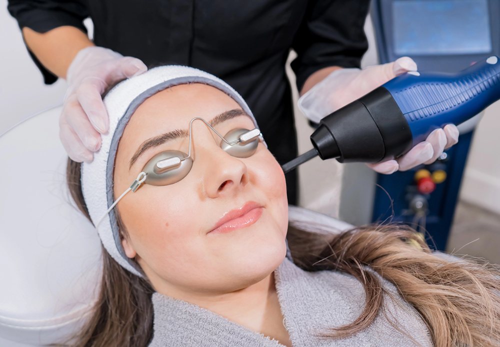 Điều trị sẹo mụn bằng laser Fractional CO2